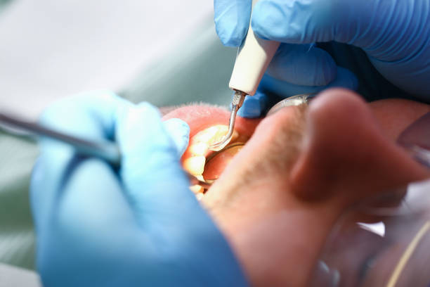 Best Cracked Tooth Emergency Dentist  in Monroe, NC